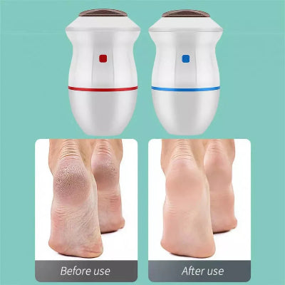 Rechargeable Electric Foot Sander and Dead Skin Remover – Heel and Foot Care Grinding Tool for Smooth, Healthy Skin