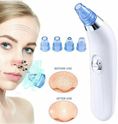 Derma Suction Vacuum Blackhead and Facial Cleaning Device